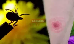 Kene Isırığı Nasıl Olur, Belirtileri Nelerdir? Kene Isırığı İzi Nasıl Görünür?