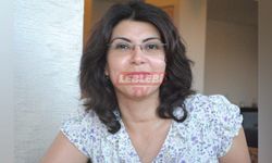 Öğretmen Esengül Acıloğlu Demir Vefat Etti