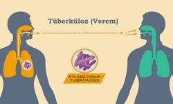 Verem (Tüberküloz) Hastalığında Devlet Yanınızda!