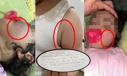 Anne Hayatının Şokunu Yaşadı! Eğitim Kurumunda Otizmli Miniğe Darp İddiası