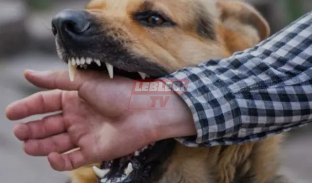 Köpeklerin Saldırısına Uğrayan Adam Kolundan Yaraladı