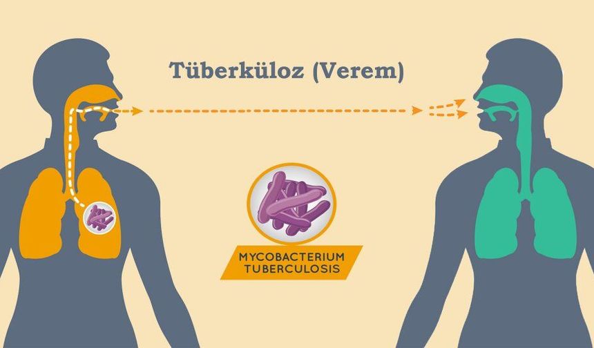 Verem (Tüberküloz) Hastalığında Devlet Yanınızda!