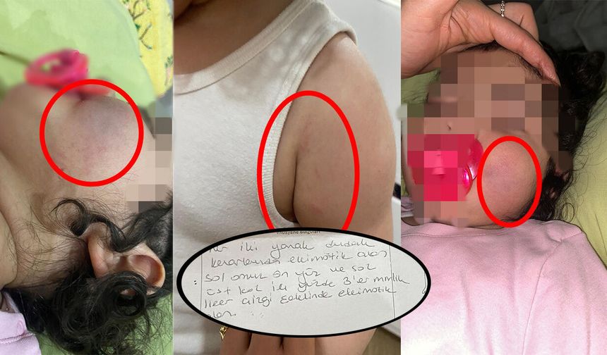 Anne Hayatının Şokunu Yaşadı! Eğitim Kurumunda Otizmli Miniğe Darp İddiası