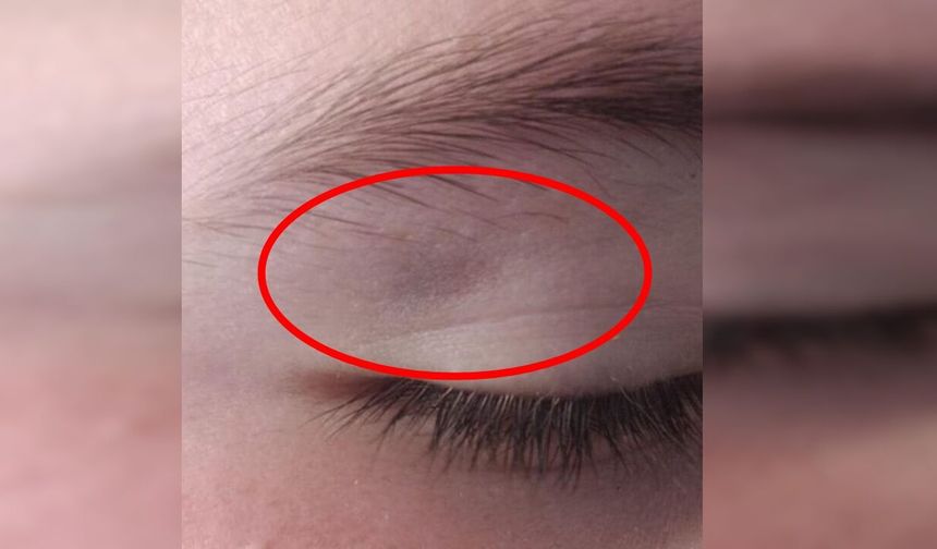 Millet Bahçesi’nde Çocuklara Saldırı İddiası