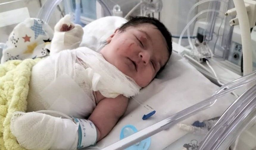 Çorum'da Yürek Yakan Acı! 20 Günlük Orhan Bebek Yaşam Savaşını Kaybetti